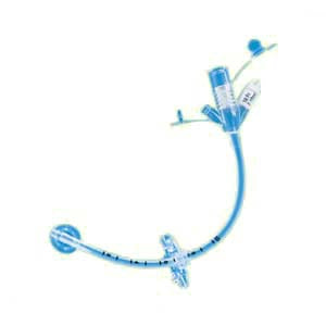 MIC Adult Gastrostomy Feeding Tube 18 fr – BuyMedical.com